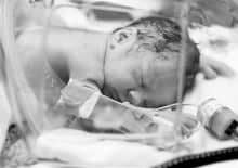 swiatowy-dzien-wczesniaka