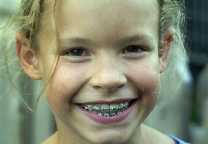 Aparat ortodontyczny dla dzieci